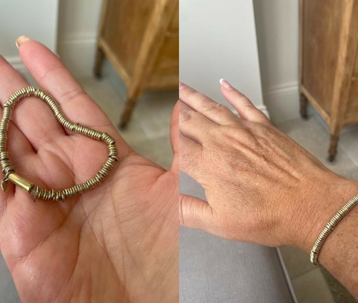 fixed-bracelet